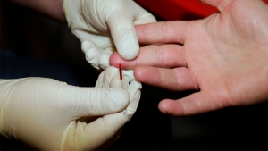 Danas u TC "Delta city" besplatno i anonimno testiranje na HIV virus